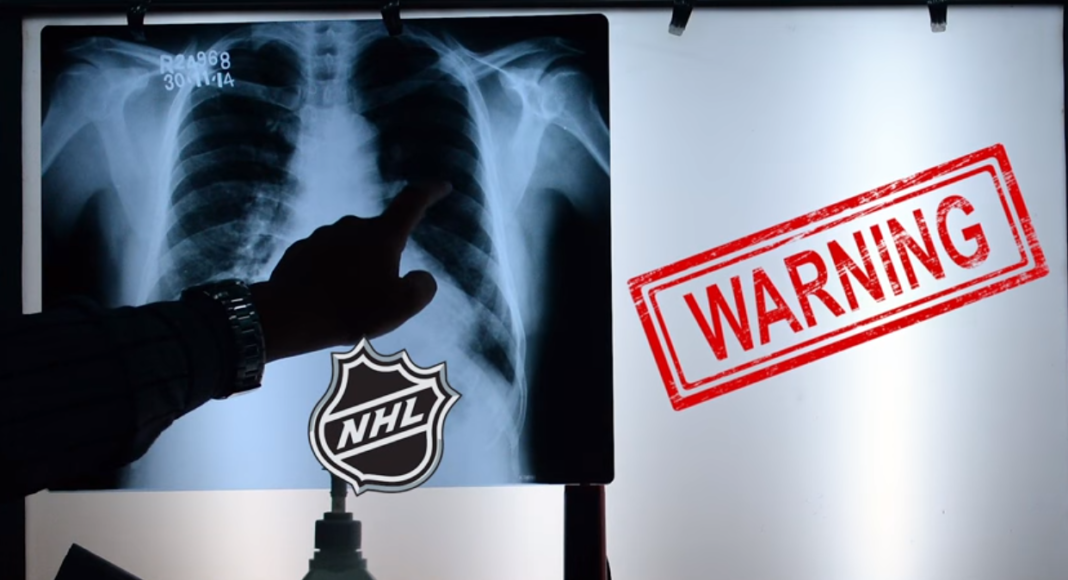 Patrzcie jacyśmy fajni, pół składu na noszach – chora mentalność NHL