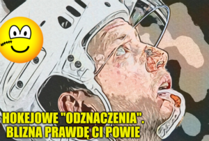Hokejowe “odznaczenia”. Blizna prawdę ci powie #2