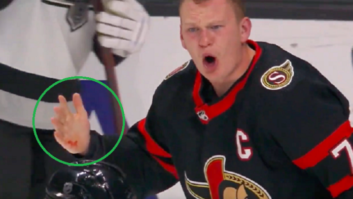 brady-tkachuk