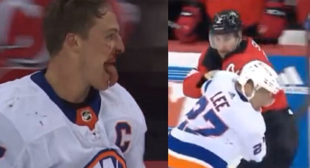 Nocna Zmiana z NHL: Koszykarska zasłona i krwawy kapitan