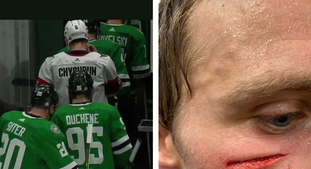 Nocna Zmiana z NHL: Tajemnica pomyłki Chychruna rozwiązana, Raanta papa