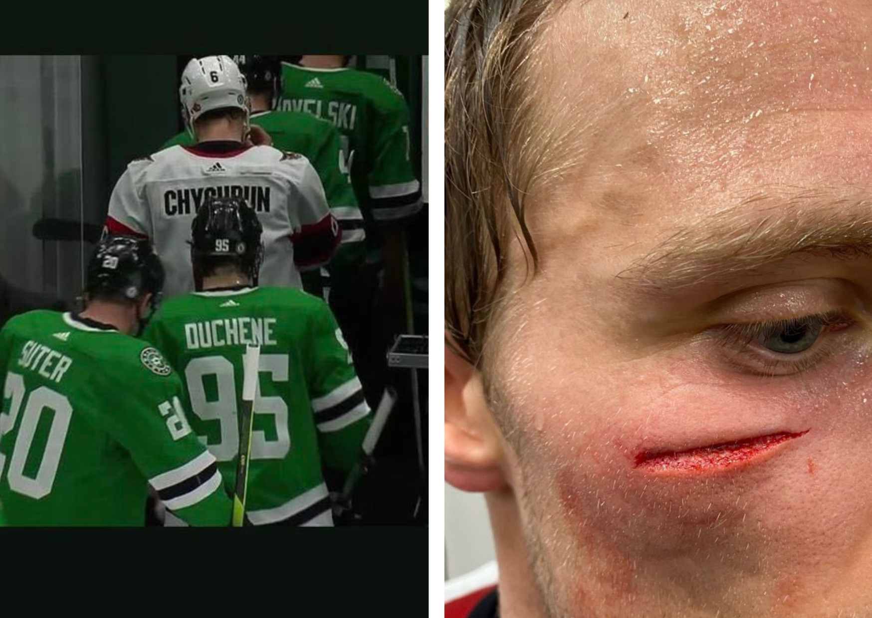 Nocna Zmiana z NHL: Tajemnica pomyłki Chychruna rozwiązana, Raanta papa