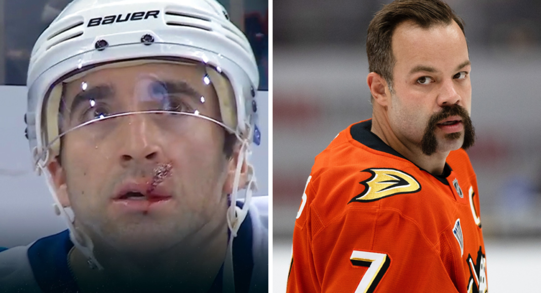 Raport z NHL. Blizna od wargi do nosa. Nowa fryzura kapitana