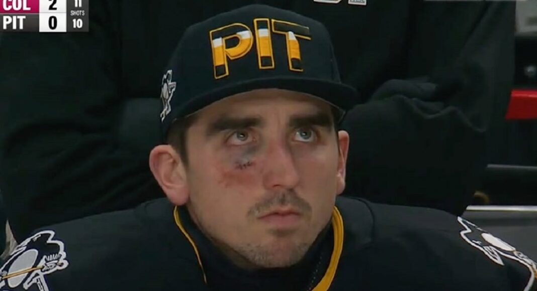 Raport z NHL. Trenerzy skoczyli sobie do gardeł. Podbite oko bramkarza
