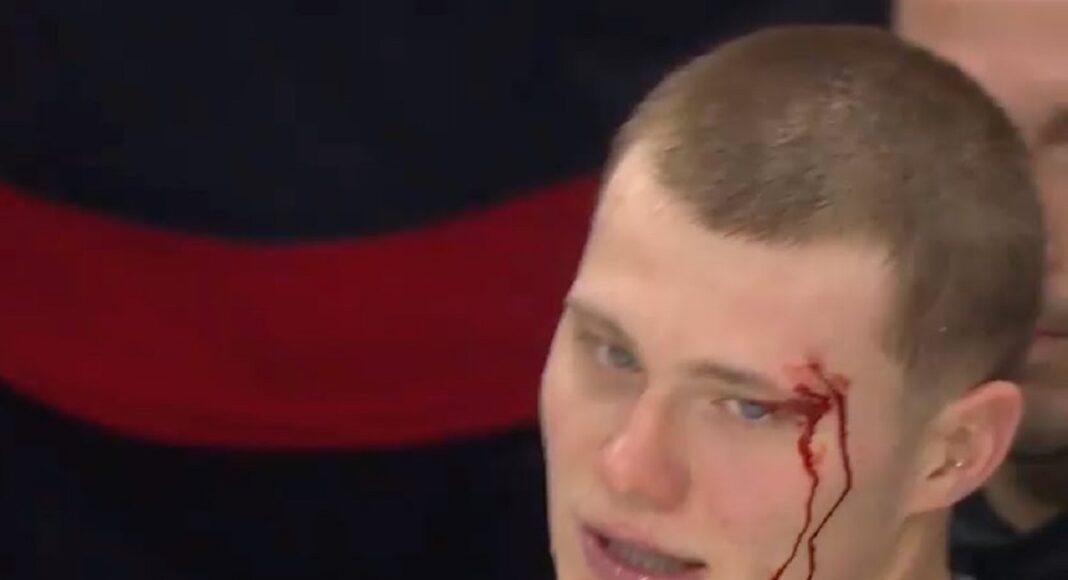 Raport z NHL: Chciał celowo kontuzjować rywala. Ale czy to cała prawda?