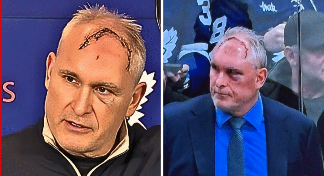 Twarz trenera NHL jest zmasakrowana! Pokazał i wyjawił co się stało. Hokej