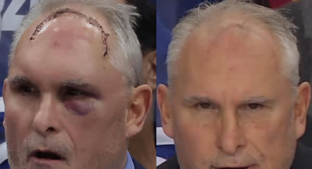 Raport z NHL. Rana goi się jak na psie, to znaczy jak na trenerze. Hokej