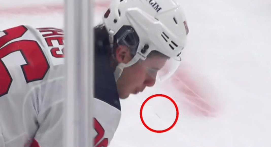 Raport z NHL. Hellebuyck zagrał dla Devils, jego kolega znów stracił ząb